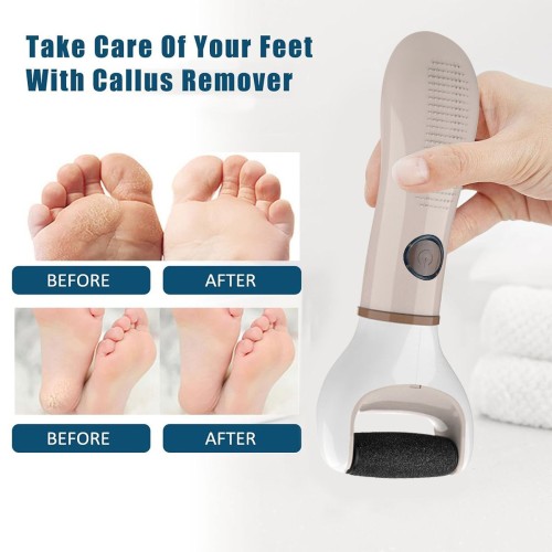 Electric Foot Callus Remover, Rechargeable Portable Electronic Foot File Pedicure Kits