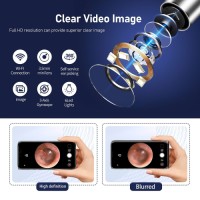 Ear Wax Removal, Ear Wax Removal with Camera, Ear Cleaning Kit, Earwax Removal Kit for iOS and Android