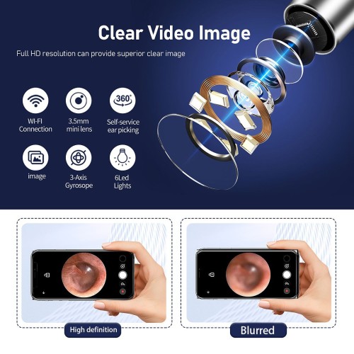 Ear Wax Removal, Ear Wax Removal with Camera, Ear Cleaning Kit, Earwax Removal Kit for iOS and Android